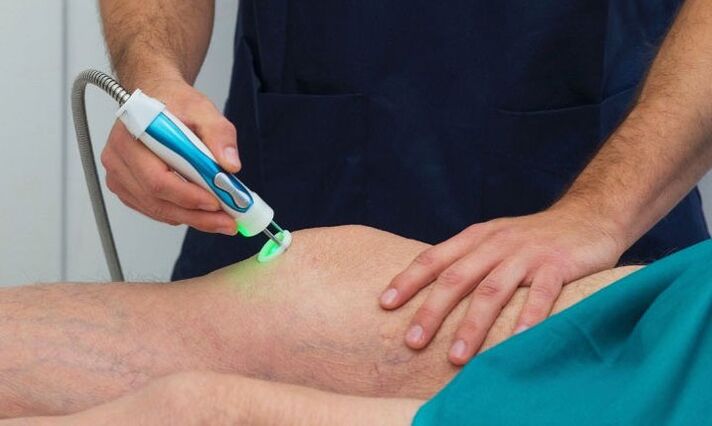 termografija zgloba koljena s artrozom
